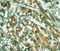 Le virus H5N1 est capable de s’adapter à l’homme